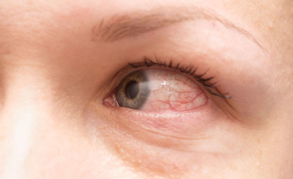 Eye Allergy Specialist Doctor Near Me